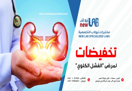 تخفيضات