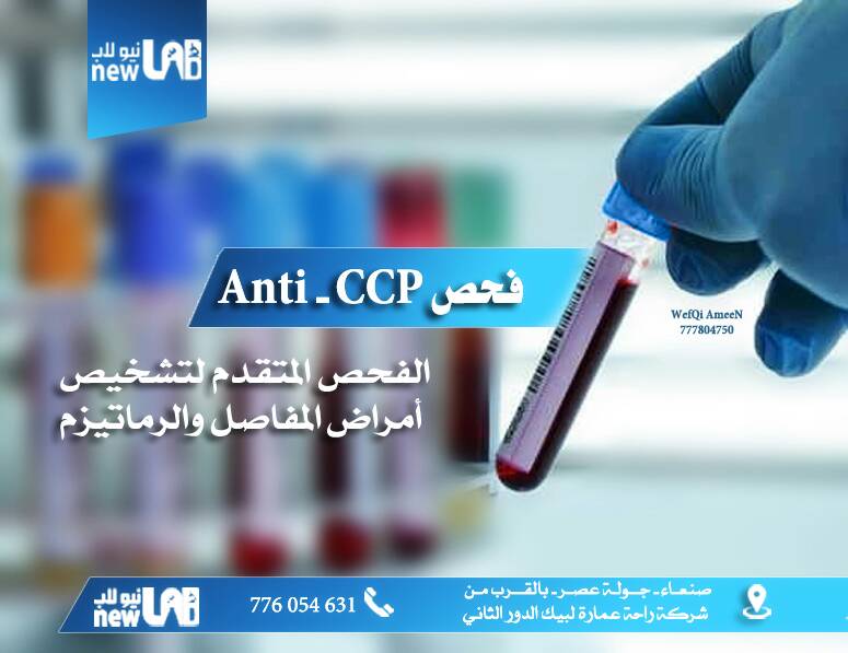 جديد نيولاب
